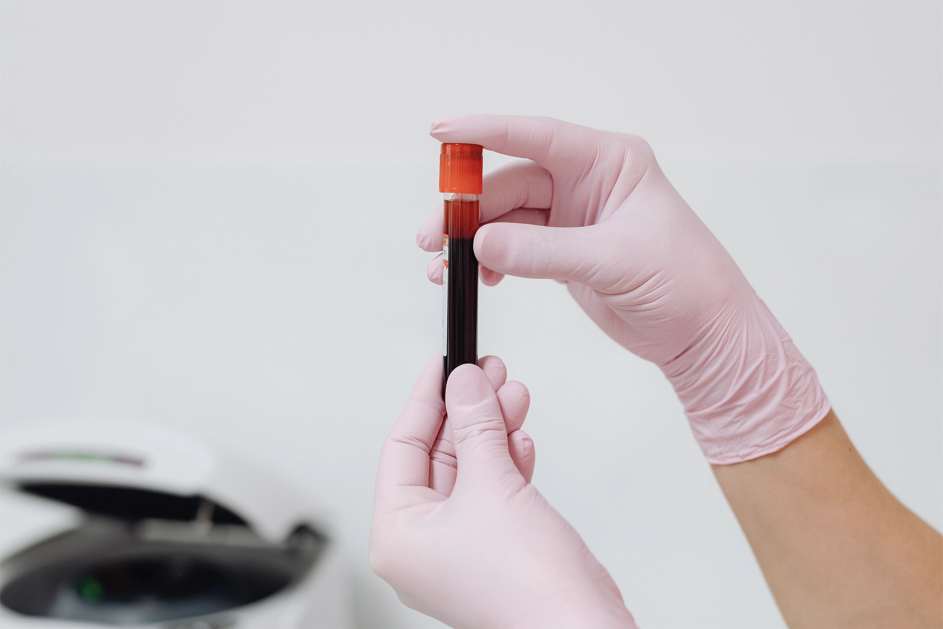 person holding vial of red liquid